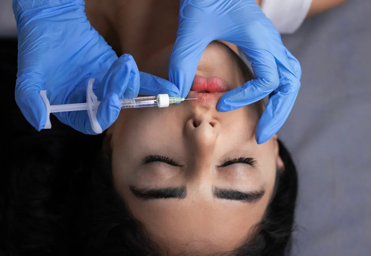 Aplicação de preenchimento com seringa no rosto de uma paciente, em close